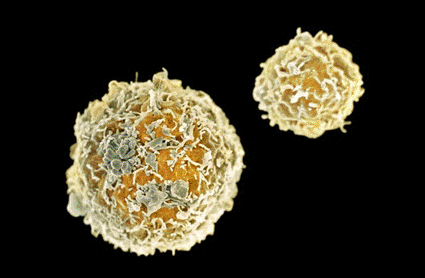 Image: Colored scanning electron micrograph (SEM) of stem cells (Photo courtesy of SPL).